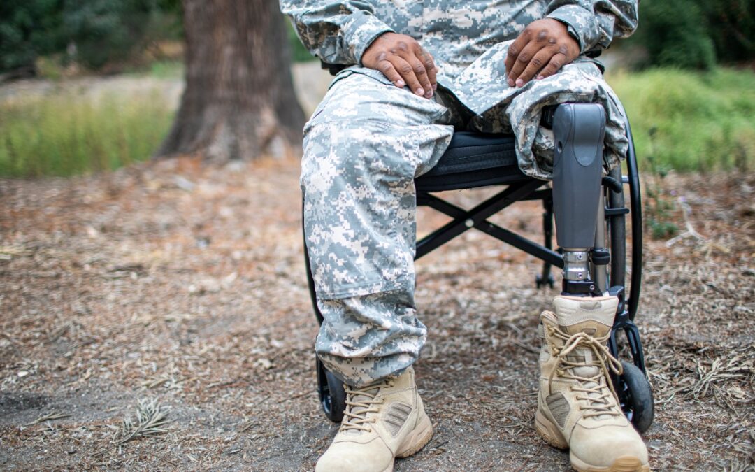 a man in military gear sitting in a wheelchair with his pants pulled up to reveal a prosthetic leg