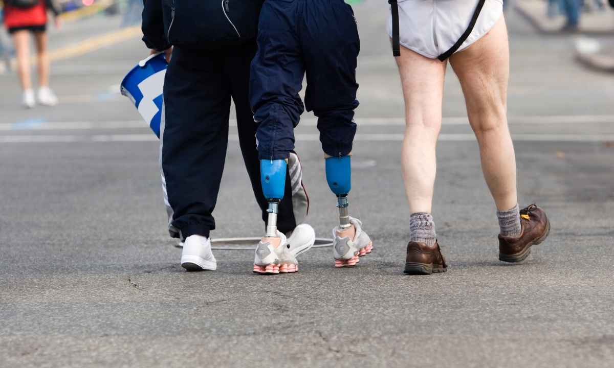 three people's legs walking, but one person has prosthetic legs