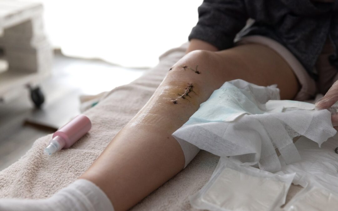 Post-Operative & Post-Hospital Care: Ensuring a Smooth Recovery for All Ages at Home